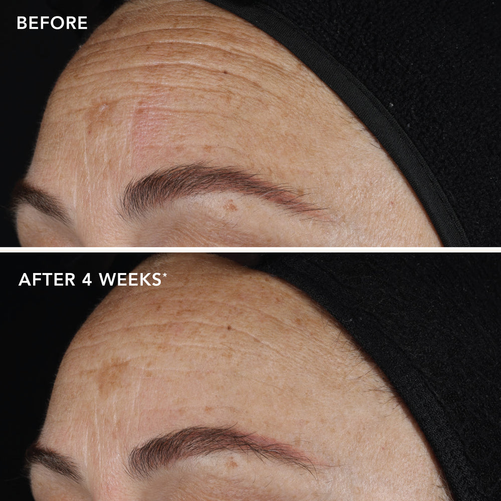 SAMPLES AGELESS+ retinol pure liquid retinol 0.1% (5-pack) TP-189