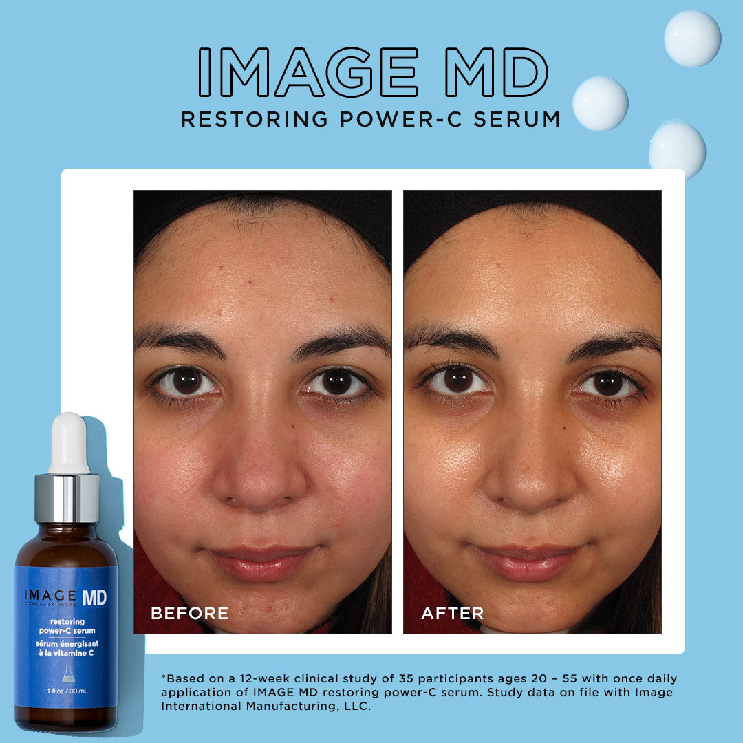 TRAVEL SIZE - IMAGE MD® restoring power-C serum - MD-326